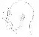 Fig. 01 - INTRAORAL MAXRETRACTOR