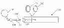 Fig. 01 - Anti-rotation instrument