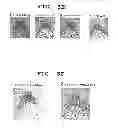 Fig. 10 - METHOD OF MEASURING THE DEGREE OF NON-INFLAMMATORY STRESS RESPONSE