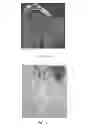 Fig. 02 - METHODS FOR EVALUATING QUANTIFYING FIBROSIS IN LUNG TISSUE