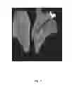 Fig. 07 - METHODS FOR EVALUATING QUANTIFYING FIBROSIS IN LUNG TISSUE