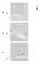 Fig. 08 - Method and system for analyzing a blood sample