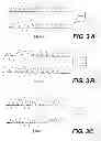 Fig. 04 - Method of prognosing and diagnosing hereditary spastic paraplegia, mutant nucleic acid molecules and polypeptides