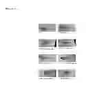 Fig. 07 - Method of prognosing and diagnosing hereditary spastic paraplegia, mutant nucleic acid molecules and polypeptides