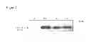 Fig. 09 - Method of prognosing and diagnosing hereditary spastic paraplegia, mutant nucleic acid molecules and polypeptides