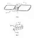 Fig. 02 - Blood bag systems for separation of whole blood and methods of use thereof