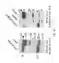 Fig. 17 - STRUCTURES OF HUMAN HISTIDYL-TRNA SYNTHETASE AND METHODS OF USE