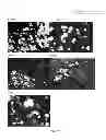 Fig. 02 - OSTEOCLAST ACTIVITY