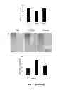 Fig. 32 - OSTEOCLAST ACTIVITY