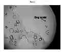 Fig. 05 - IMMEDIATE RELEASE PHARMACEUTICAL FORMULATION OF 4-[3-(4-CYCLOPROPANECARBONYL-PIPERAZINE-1-CARBONYL)-4-FLUORO-BENZYL]-2H-PHTHALAZIN-1-ONE