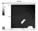 Fig. 20 - IMMEDIATE RELEASE PHARMACEUTICAL FORMULATION OF 4-[3-(4-CYCLOPROPANECARBONYL-PIPERAZINE-1-CARBONYL)-4-FLUORO-BENZYL]-2H-PHTHALAZIN-1-ONE