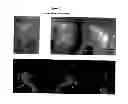 Fig. 04 - Compositions and methods for treatment of ear disorders