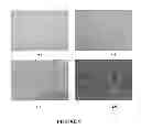Fig. 10 - Novel Biodegradable Elastomeric Scaffold for Tissue Engineering and Light Scattering Fingerprinting Methods for Testing the Same