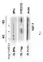 Fig. 02 - Molecular marker CUEDC2 protein for prognostic determination of breast cancer endocrinology therapy