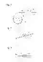 Fig. 02 - Brachytherapy and buttress element co-delivery