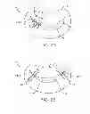 Fig. 04 - METHODS AND DEVICES FOR TISSUE GRASPING AND ASSESSMENT