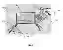 Fig. 08 - Stereoscopic System for Minimally Invasive Surgery Visualization