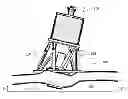 Fig. 01 - METHOD FOR MINIMALLY INVASIVE SURGERY STEROSCOPIC VISUALIZATION