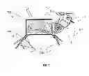 Fig. 08 - METHOD FOR MINIMALLY INVASIVE SURGERY STEROSCOPIC VISUALIZATION