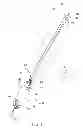 Fig. 02 - ENDOSCOPE CAP FOR CATHETER DEPLOYMENT