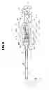 Fig. 09 - Insertion apparatus