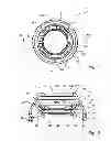 Fig. 02 - Spacer attachment for a dermatoscope