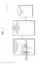 Fig. 02 - Method and apparatus for capturing magnetic resonance image