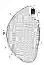 Fig. 02 - PROSTHETIC IMPLANT SHELL