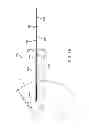 Fig. 35 - Apparatus, systems, and methods for localizing markers or tissue structures within a body