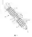 Fig. 02 - SPINAL IMPLANT SYSTEM AND METHODS OF USE