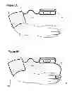 Fig. 07 - Method and Apparatus For Improved Wound Healing and Enhancement of Rehabilitation