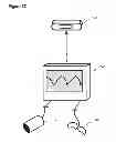 Fig. 08 - Method and Apparatus For Improved Wound Healing and Enhancement of Rehabilitation