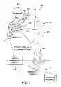 Fig. 02 - System and method for reconstructing cardiac activation information