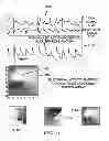 Fig. 08 - System and method for reconstructing cardiac activation information