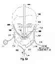 Fig. 06 - Nasal interface device