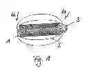 Fig. 02 - BLADDER PRESSURE MEASUREMENT SYSTEM