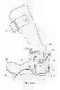 Fig. 02 - Ankle-foot orthotic