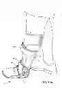 Fig. 07 - Ankle-foot orthotic