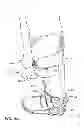 Fig. 08 - Ankle-foot orthotic