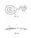 Fig. 02 - EXPANDABLE FLUID DRAINAGE IMPLANTS AND ASSOCIATED DELIVERY DEVICES AND METHODS