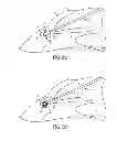 Fig. 07 - EXPANDABLE FLUID DRAINAGE IMPLANTS AND ASSOCIATED DELIVERY DEVICES AND METHODS