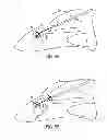Fig. 08 - EXPANDABLE FLUID DRAINAGE IMPLANTS AND ASSOCIATED DELIVERY DEVICES AND METHODS