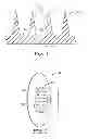 Fig. 02 - MICRONEEDLE DEVICES AND METHODS