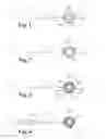 Fig. 02 - ANATOMIC DEVICE DELIVERY AND POSITIONING SYSTEM AND METHOD OF USE