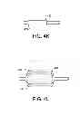 Fig. 09 - Retractable sheath devices, systems, and methods