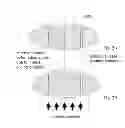 Fig. 03 - Device and procedure to treat presbyopia