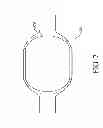 Fig. 08 - Hepatic neuromodulation devices