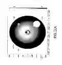 Fig. 22 - Hepatic neuromodulation devices