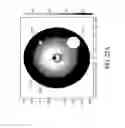 Fig. 22 - Hepatic denervation systems