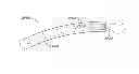 Fig. 01 - Gastroduodenal artery neuromodulation